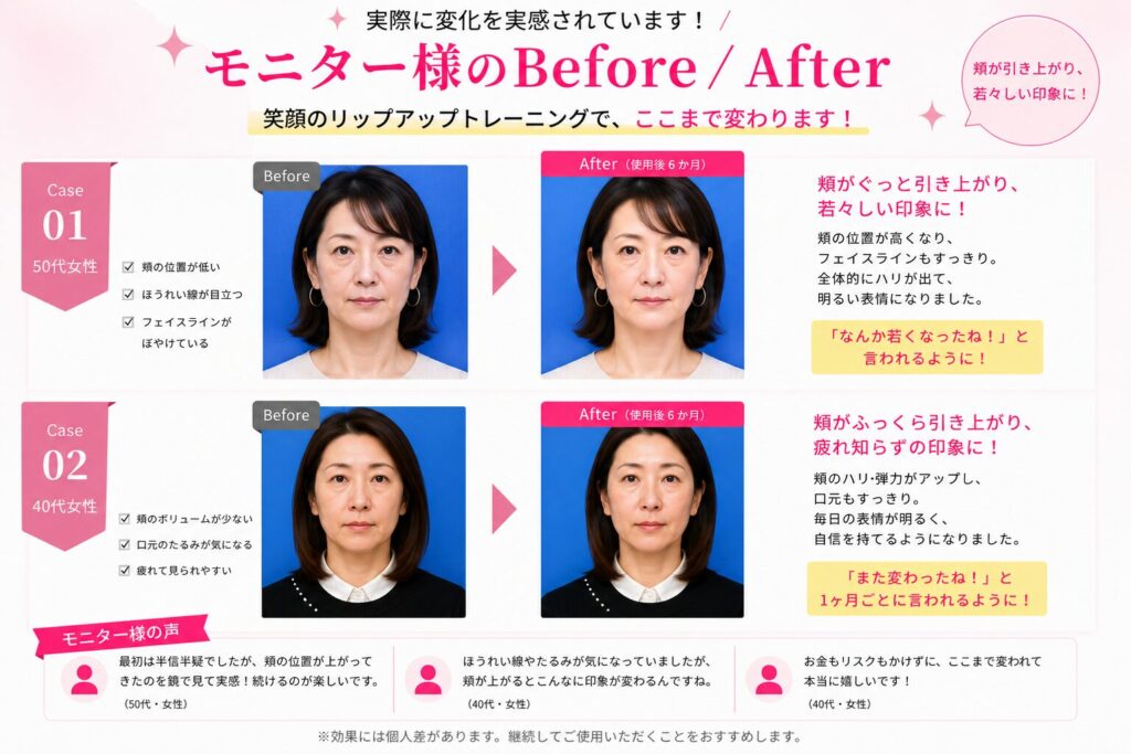 LipUpの笑顔トレーニングによるBefore/After比較。50代女性と40代女性の6か月使用後の変化を掲載。頬の引き上がり、フェイスラインの改善、口元のもたつき改善、肌のハリ感アップを紹介。