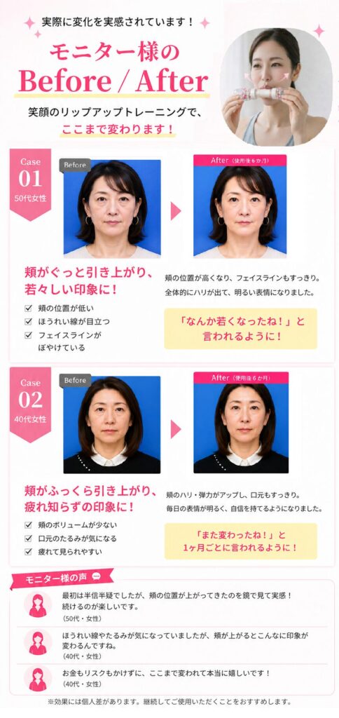 LipUpの笑顔トレーニングによるBefore/After比較。50代女性と40代女性の6か月使用後の変化を掲載。頬の引き上がり、フェイスラインの改善、口元のもたつき改善、肌のハリ感アップを紹介。